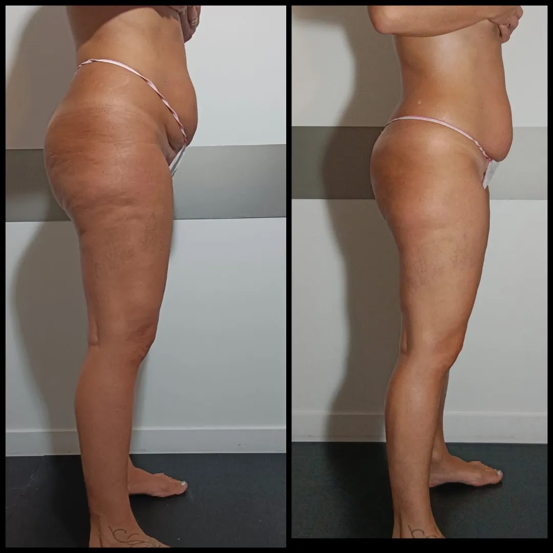 Herbana massoterapia · Foto 3